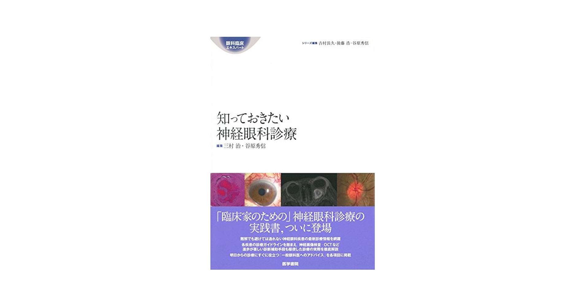 (裁断済み)知っておきたい神経眼科診療 Amazon.co.jp: 知っておきたい神経眼科診療 (眼科臨床